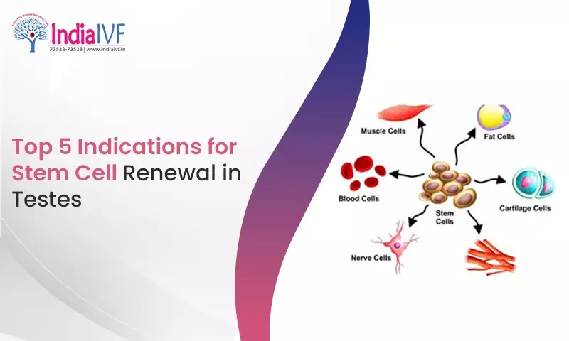 Top 5 Indications for Stem Cell Renewal in Testes
