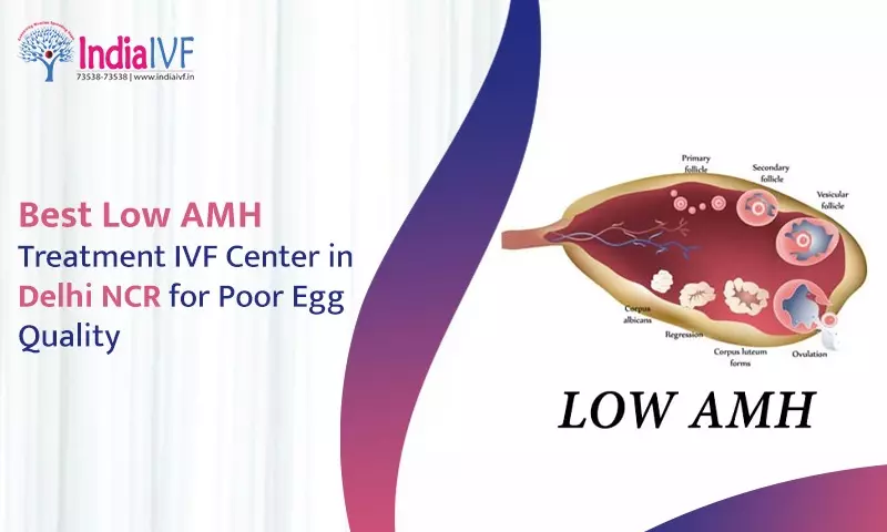Best Low AMH Treatment IVF Center in Delhi NCR for Poor Egg Quality: India IVF Fertility’s Special Treatments