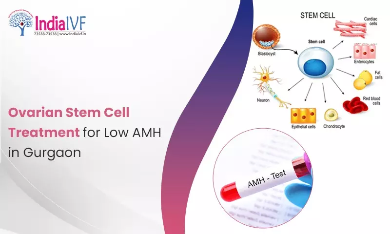 Stem Cell Treatment for Low AMH in Gurgaon