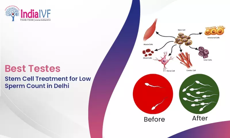 Best Testes Stem Cell Treatment for Low Sperm Count in Delhi: India IVF Fertility