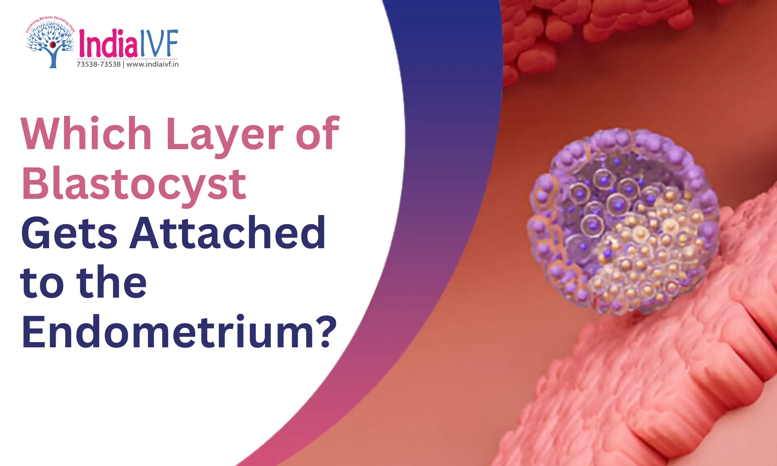 Which Layer of Blastocyst Gets Attached to the Endometrium? Expert Insights on IVF Implantation