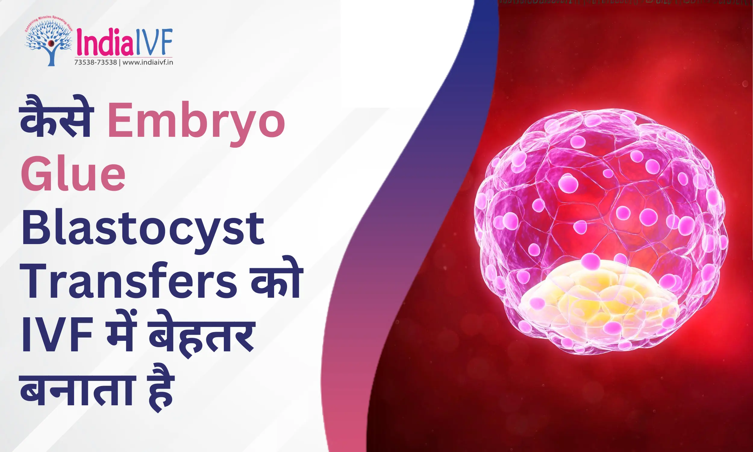 कैसे Embryo Glue Blastocyst Transfers को IVF में बेहतर बनाता है