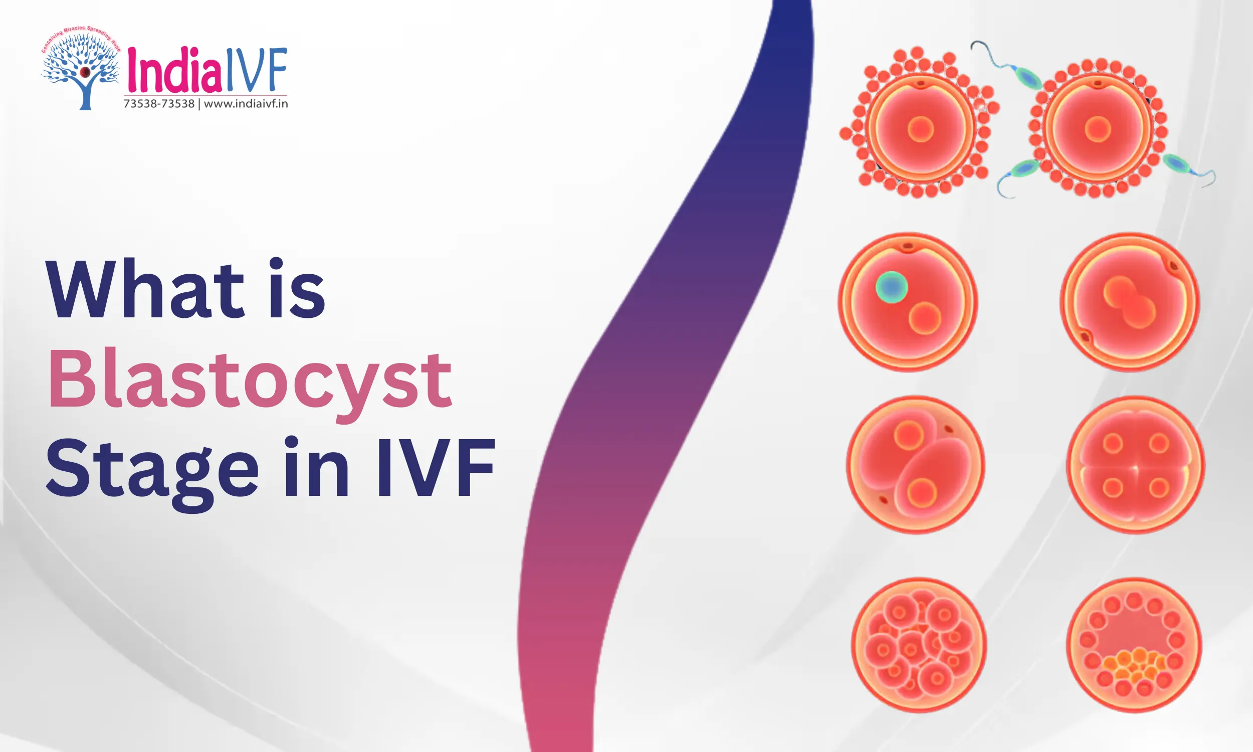 What is Blastocyst Stage in IVF