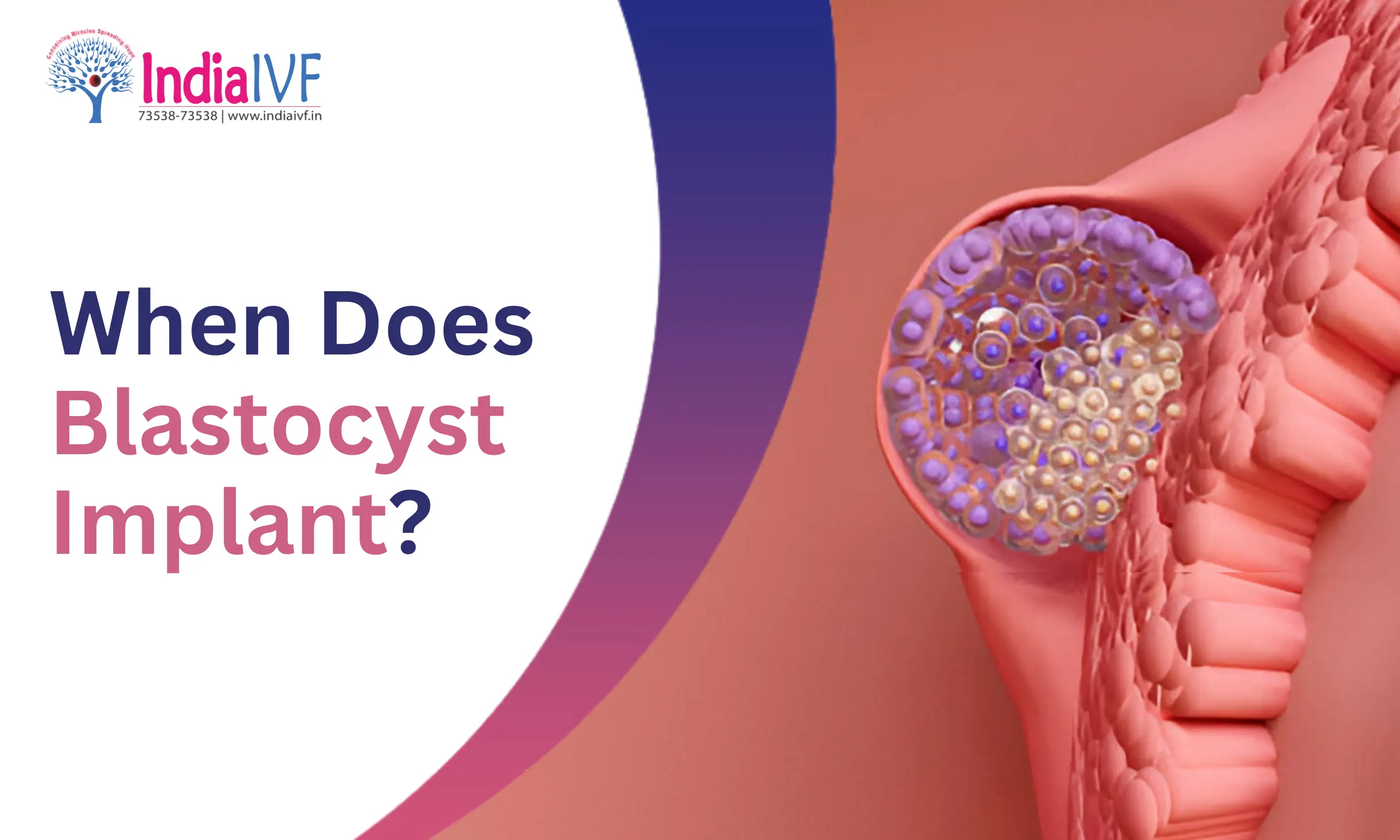 When Does Blastocyst Implant