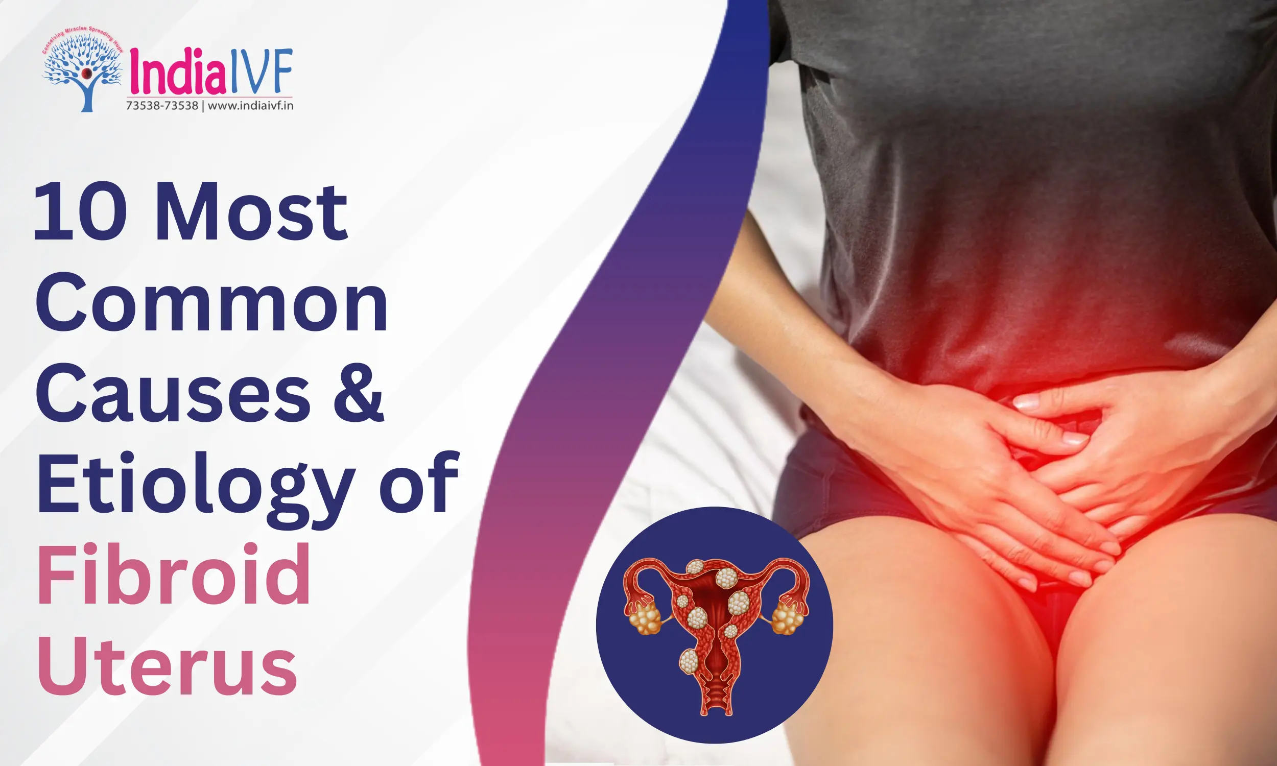 Causes & Etiology of Fibroid Uterus