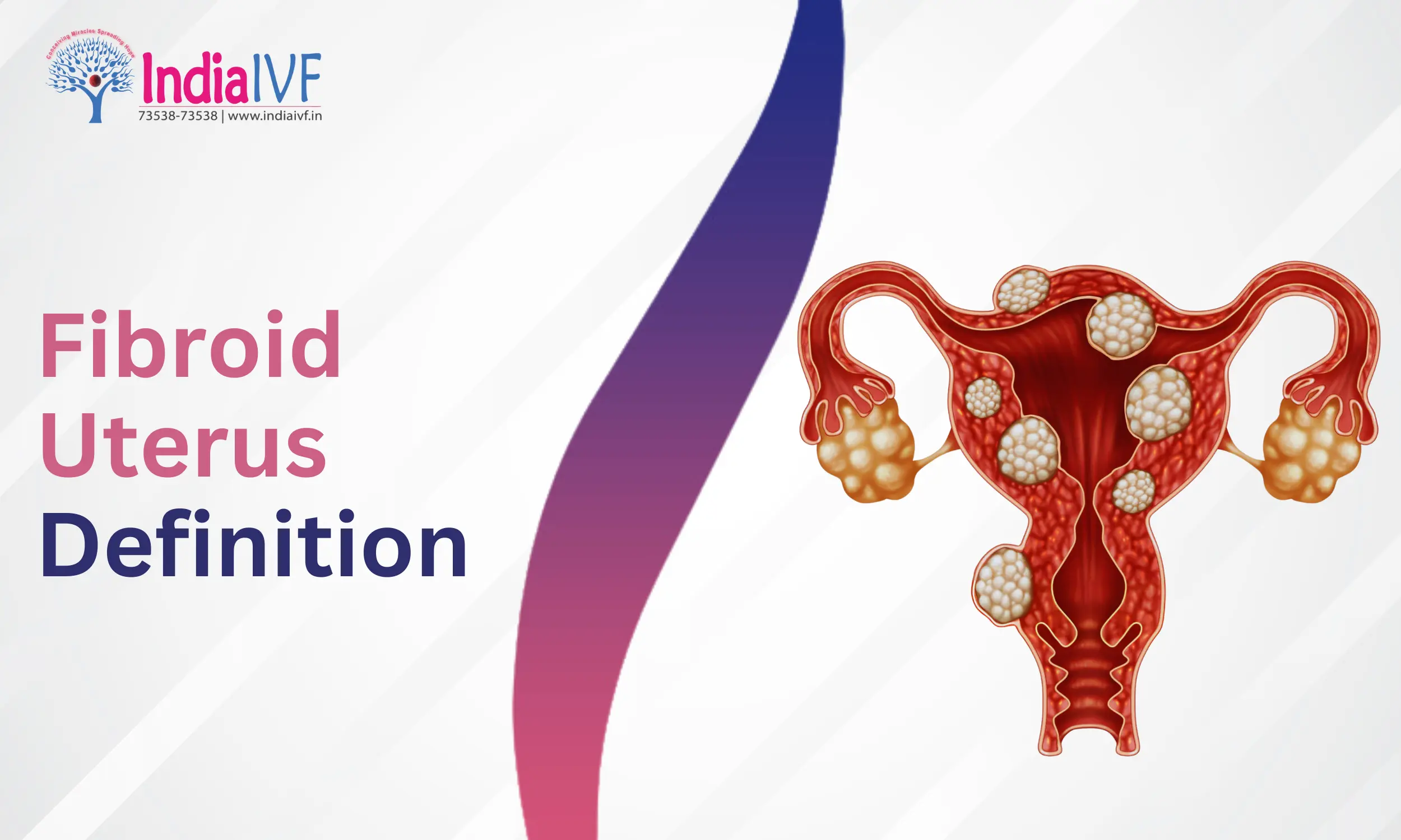 Fibroid Uterus Definition