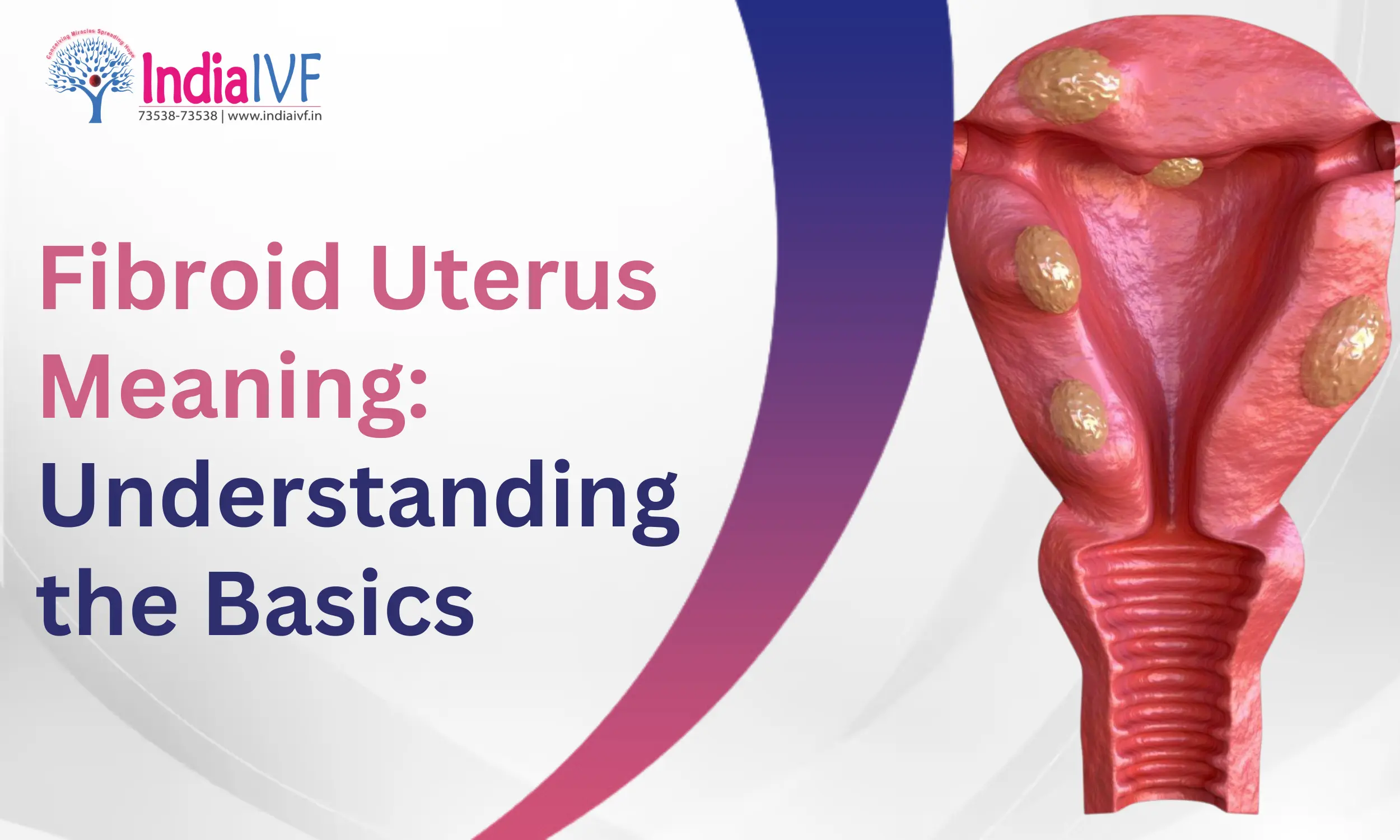 Fibroid Uterus Meaning