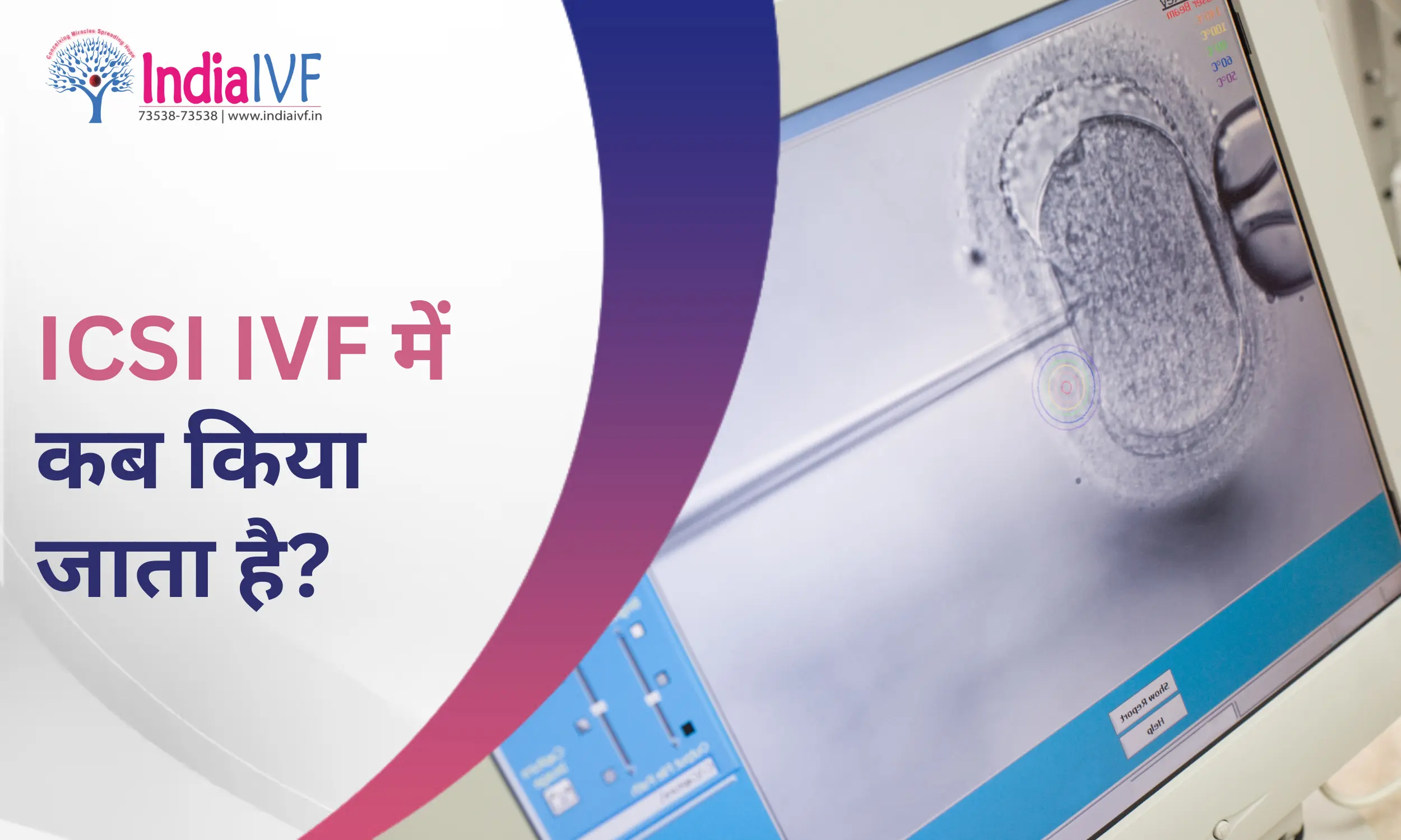 ICSI IVF में कब किया जाता है?