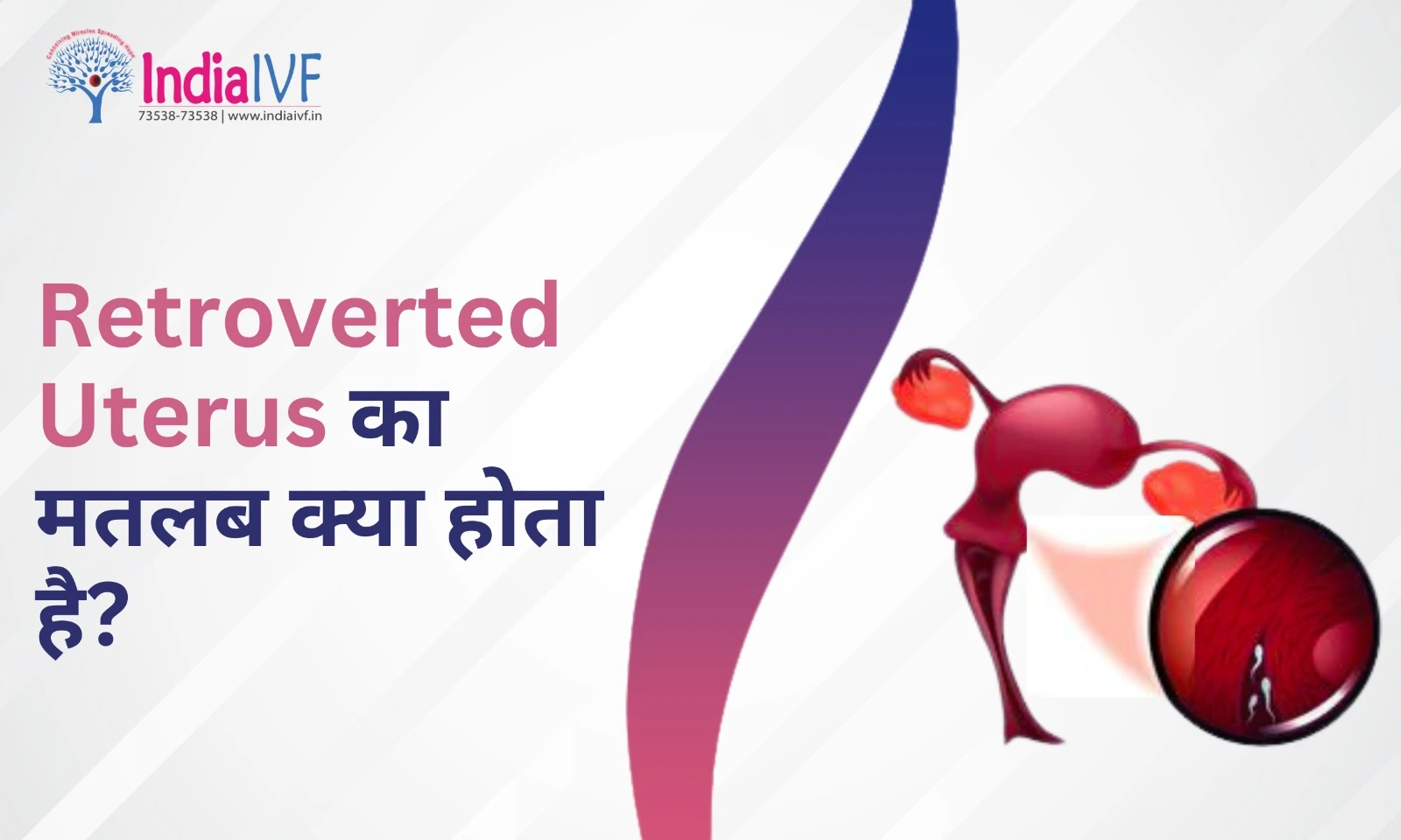 Retroverted Uterus का मतलब क्या होता है? सब कुछ जो आपको जानना चाहिए!