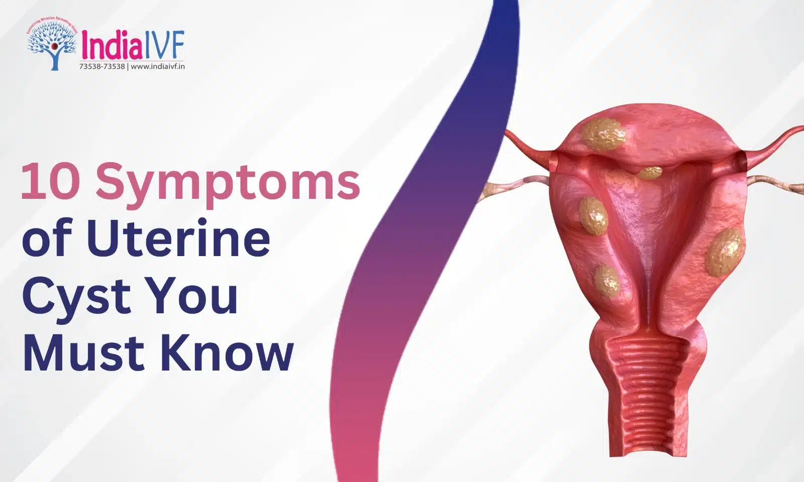 Symptoms of Uterine Cyst