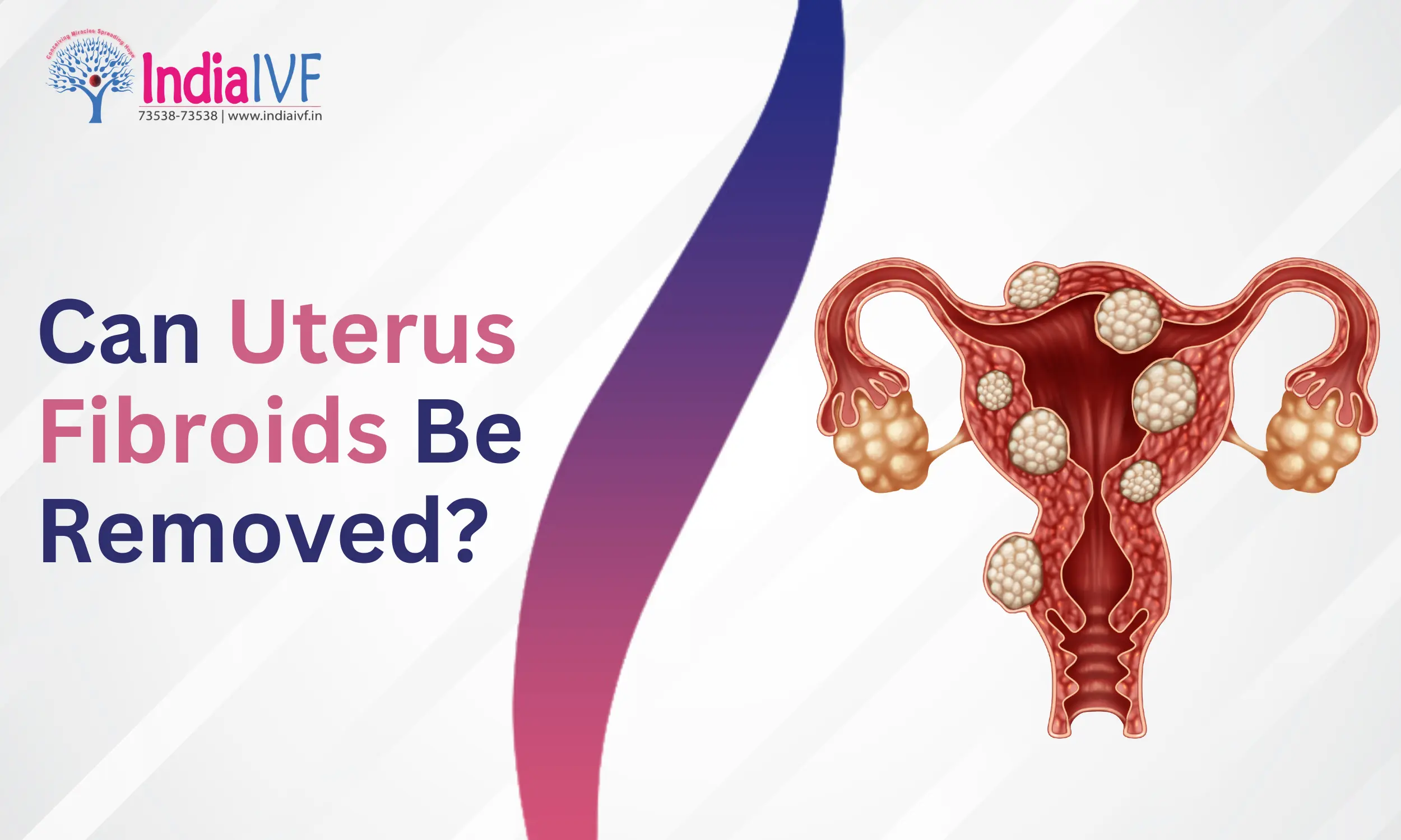 Uterus Fibroids Be Removed