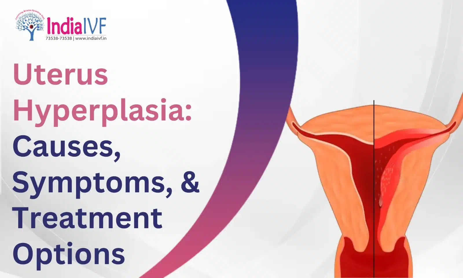 Understanding Uterus Hyperplasia: Causes, Symptoms, and Treatment Options