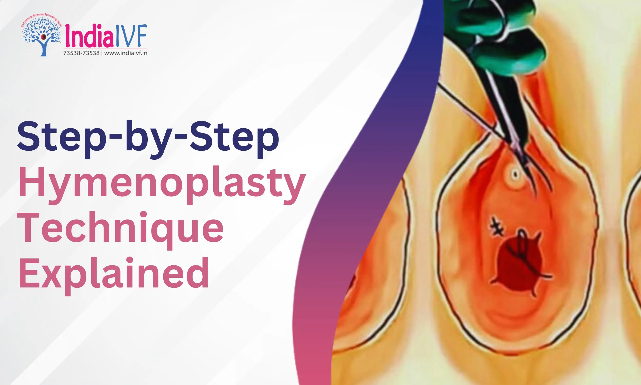 Step-by-Step Hymenoplasty Technique Explained